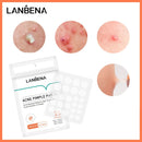 Adesivo Removedor de Espinha - Lanbena