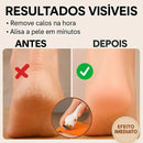 Lixa Elétrica Portátil Regarregável