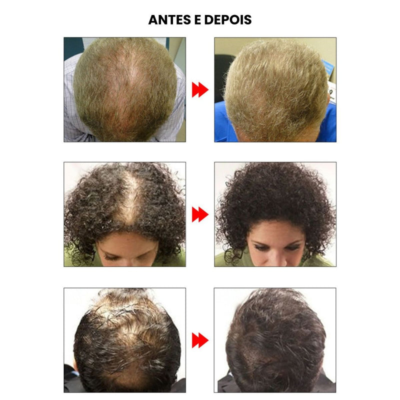 Óleo para Shampoo Lanbena – Fortalece e Reduz a Queda